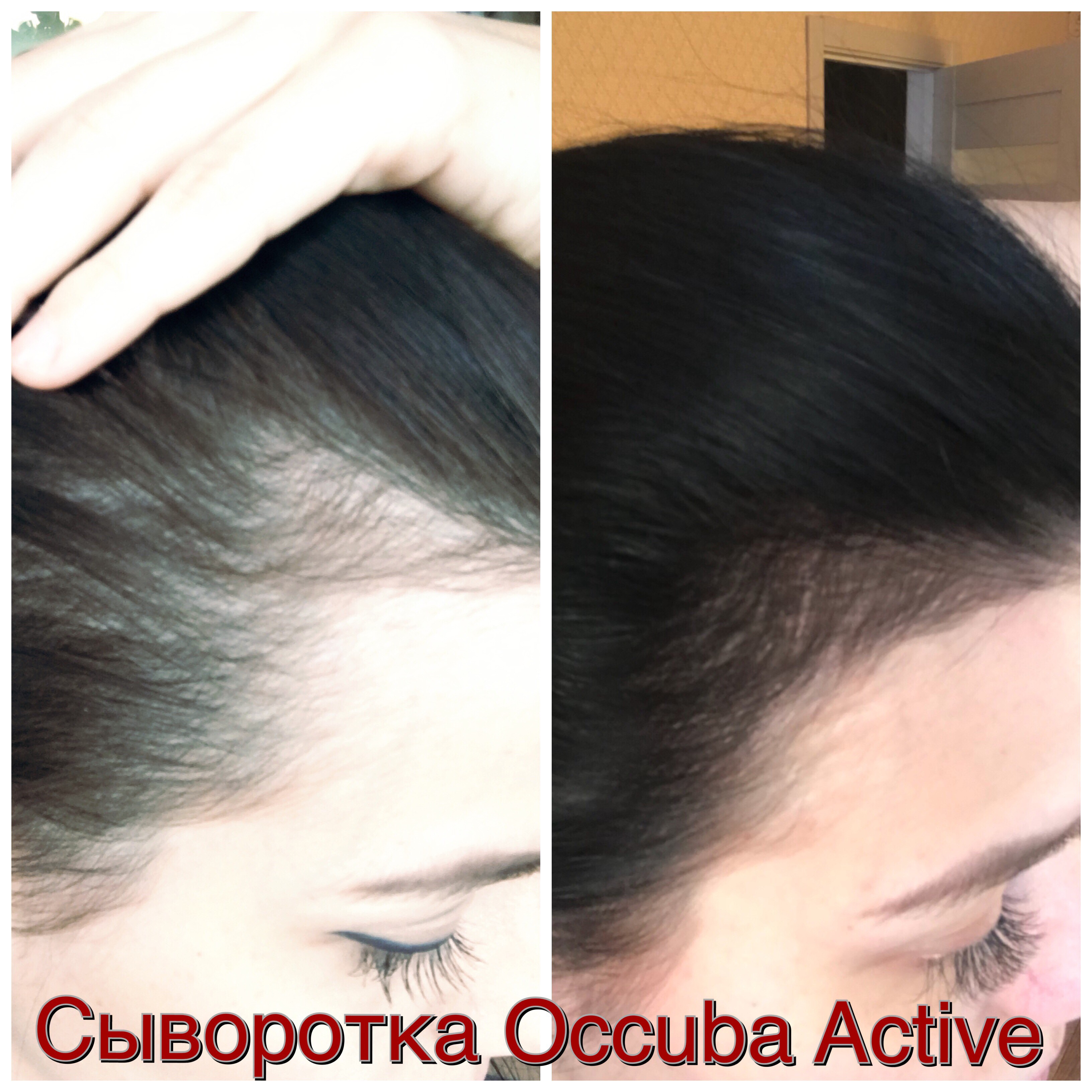 Кофе для волос — эффективное средство для роста и против выпадения Кофе для волос — эффективное средство для роста и против выпадения